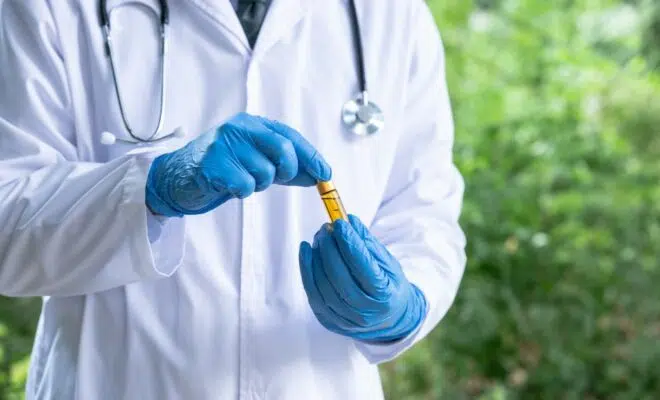 un dépistage de drogue et CBD
