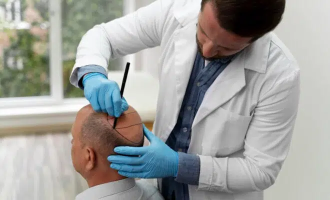 transplantation cheveux