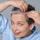 traitement alopécie